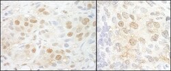 CBP20 Antibody, Novus Biologicals 0.1mg; Unlabeled:Antibodies, Polyclonal